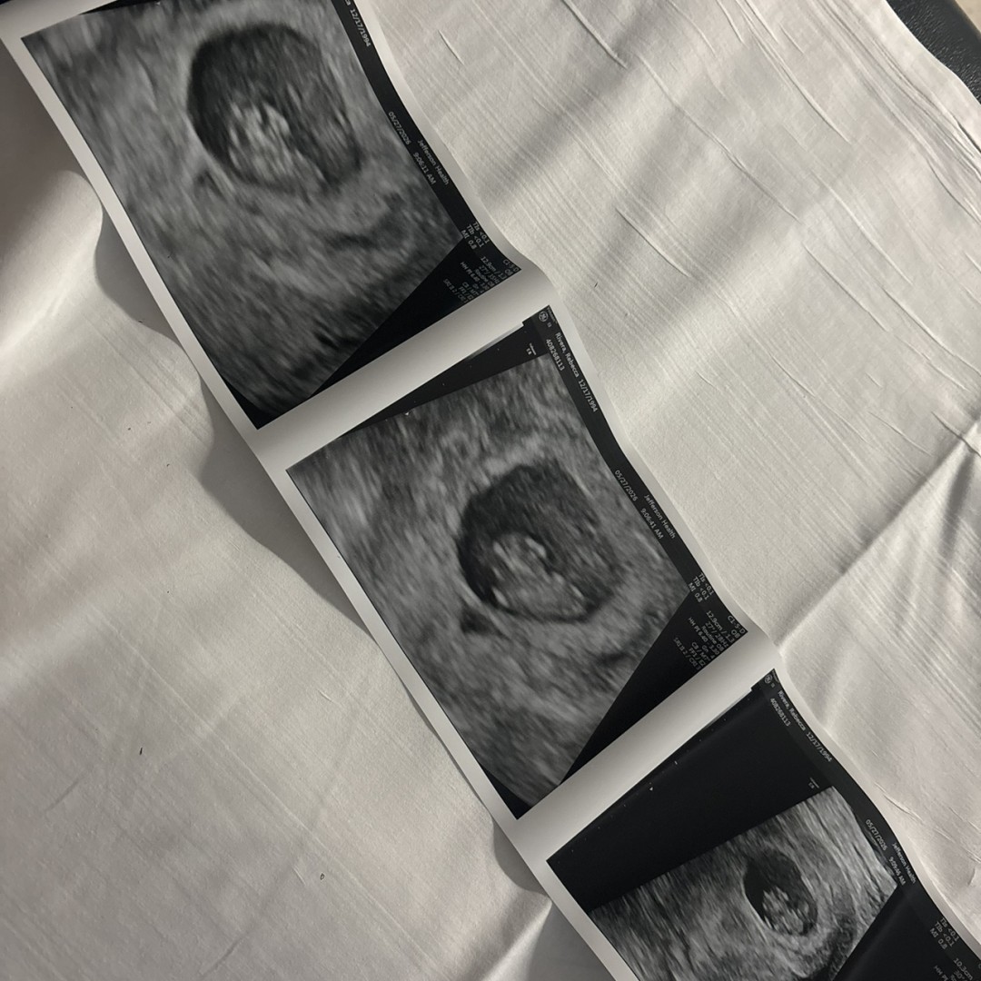 Photo shared by Rebecca for their Babylist baby registry.