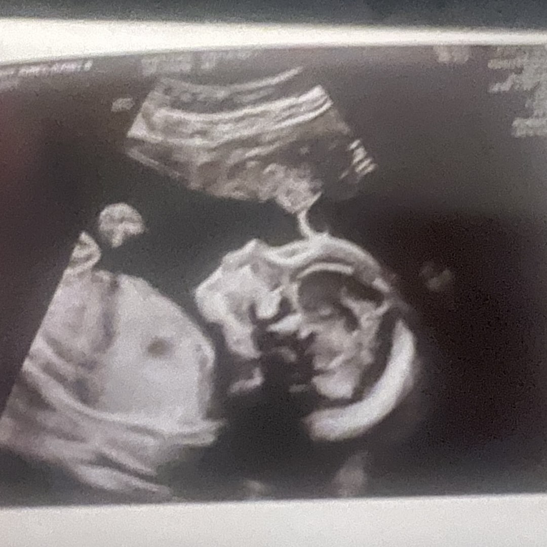 Photo shared by Isabel for their Babylist baby registry.