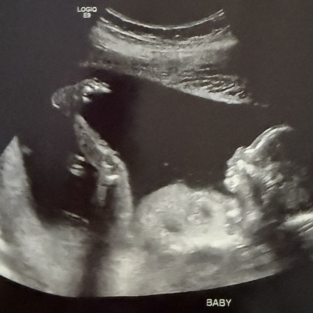 Photo shared by Michelle for their Babylist baby registry.