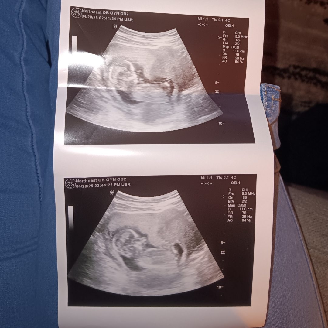 Photo shared by Brodie for their Babylist baby registry.