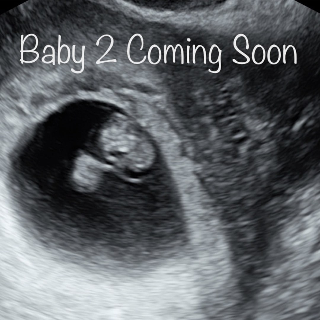 Photo shared by Priscilla for their Babylist baby registry.