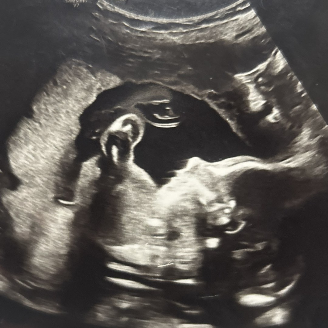 Photo shared by Kye for their Babylist baby registry.