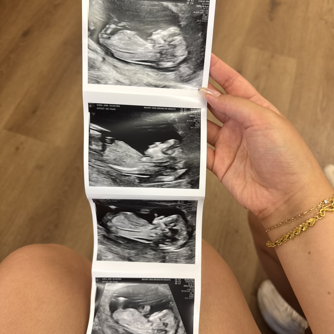 Photo shared by Jane for their Babylist baby registry.