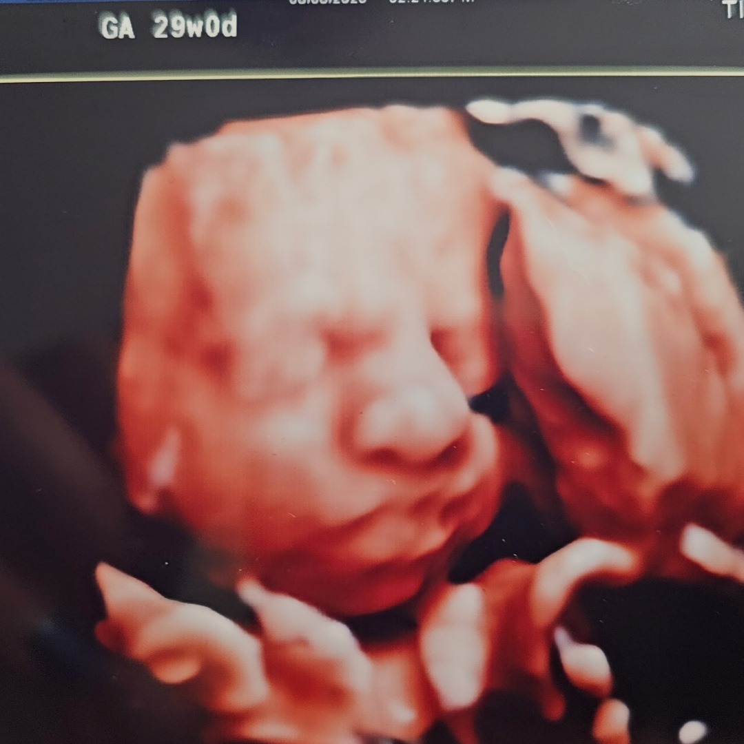 Photo shared by Kensey for their Babylist baby registry.