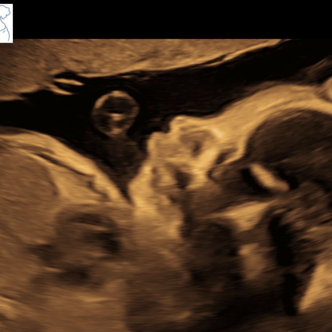 Photo shared by Sarah for their Babylist baby registry.
