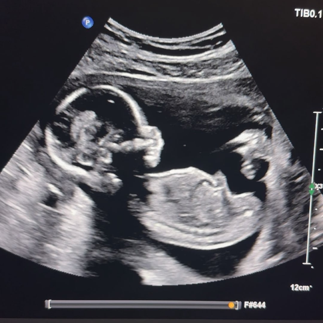 Photo shared by Jessica for their Babylist baby registry.