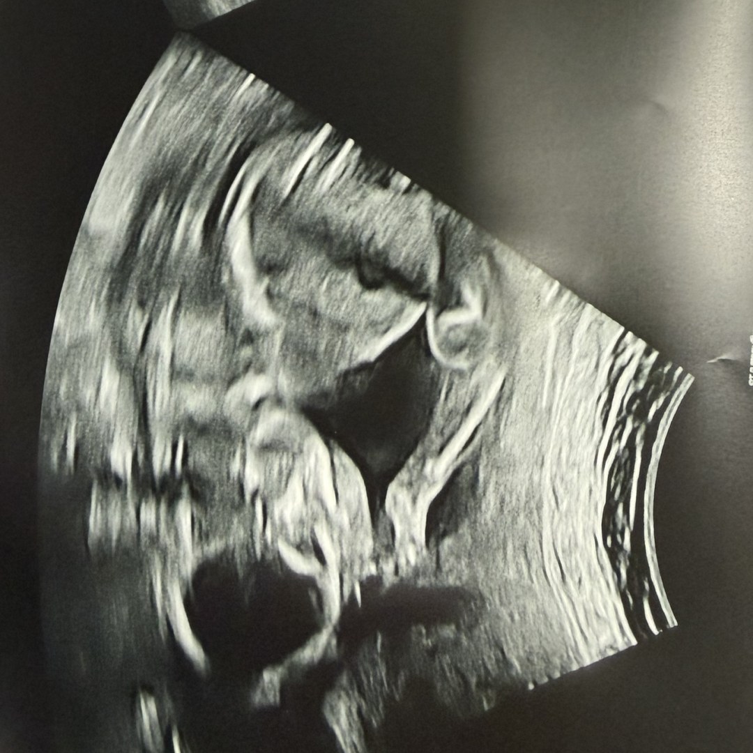 Photo shared by Jamie for their Babylist baby registry.