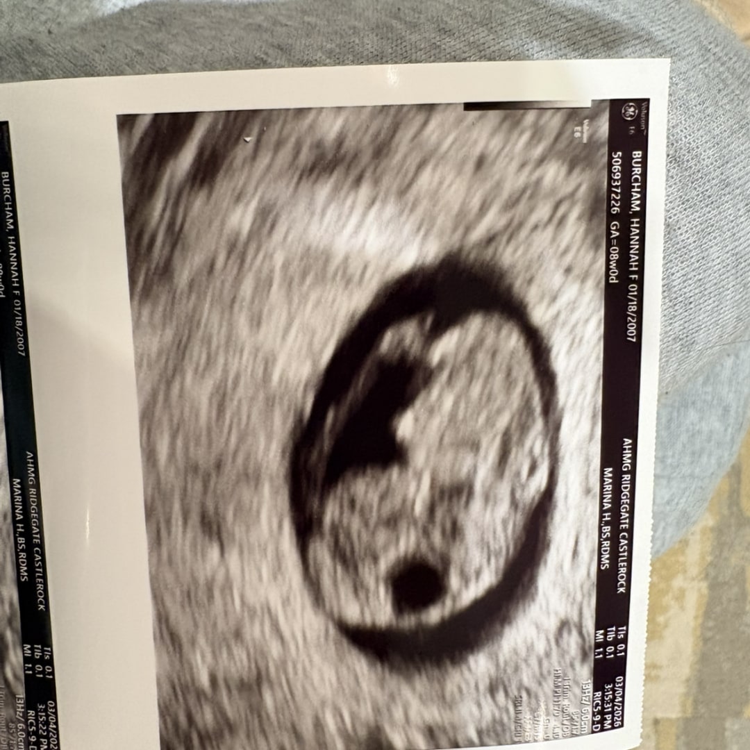 Photo shared by Hannah for their Babylist baby registry.