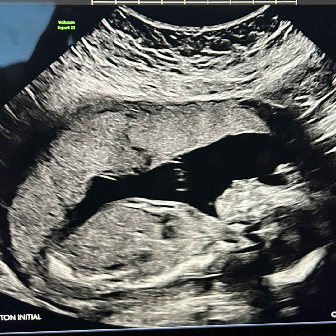 Photo shared by Yesenia for their Babylist baby registry.