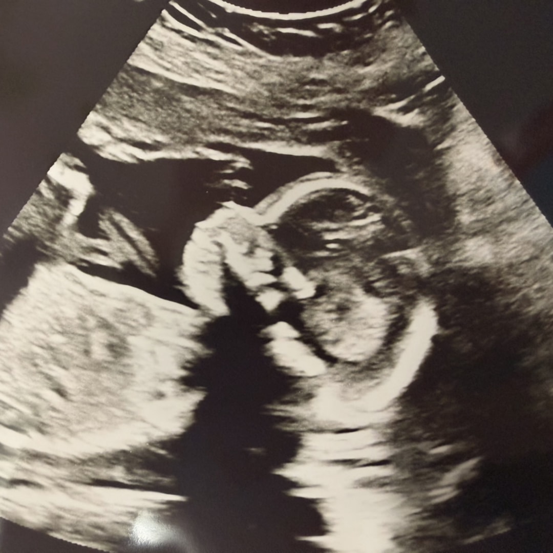 Photo shared by Taylor for their Babylist baby registry.