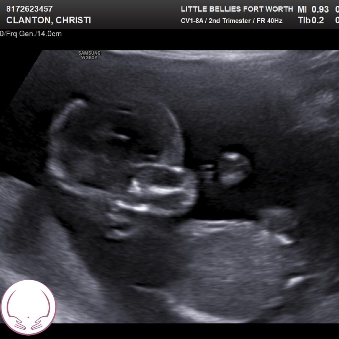 Photo shared by Christi for their Babylist baby registry.