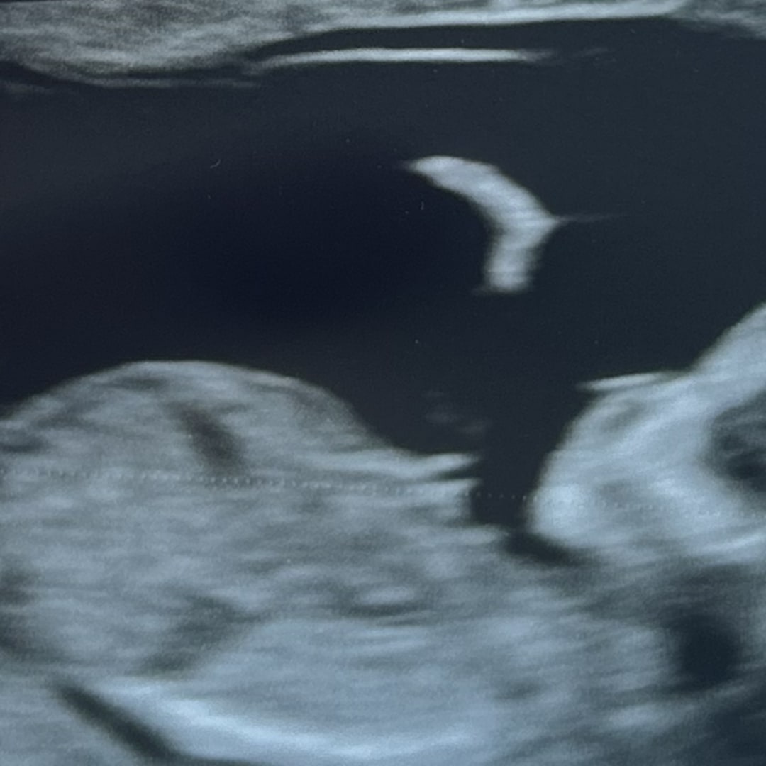 Photo shared by Marcela for their Babylist baby registry.