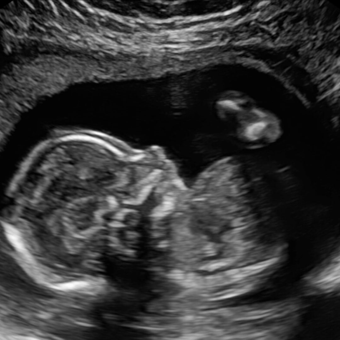 Photo shared by Kylie for their Babylist baby registry.