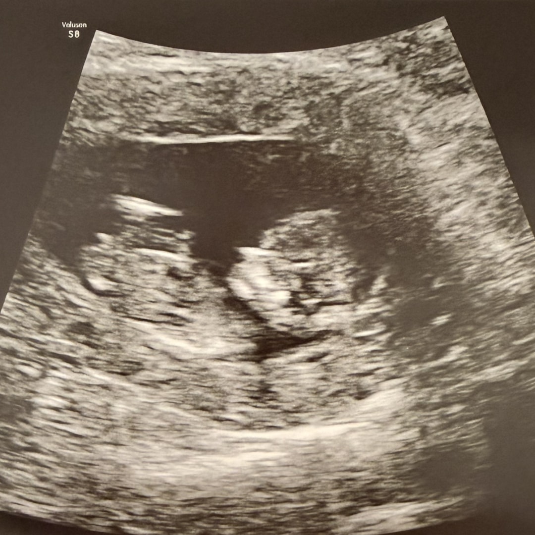 Photo shared by Erica for their Babylist baby registry.