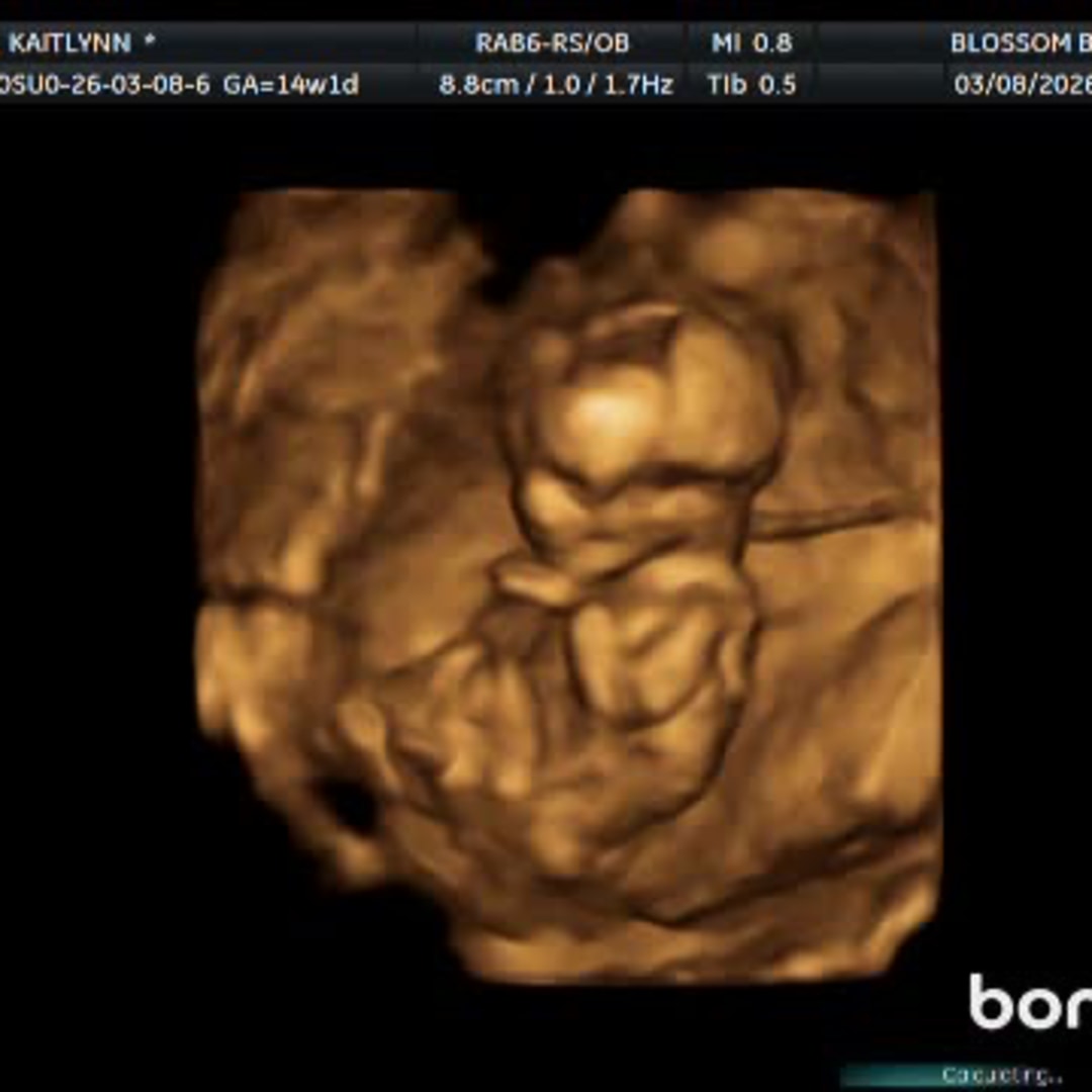 Photo shared by Kaitlynn for their Babylist baby registry.