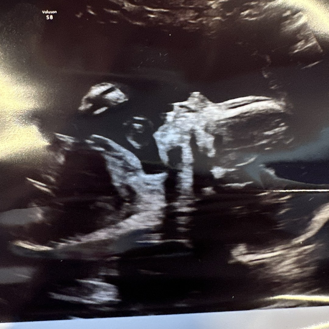 Photo shared by Sarah for their Babylist baby registry.