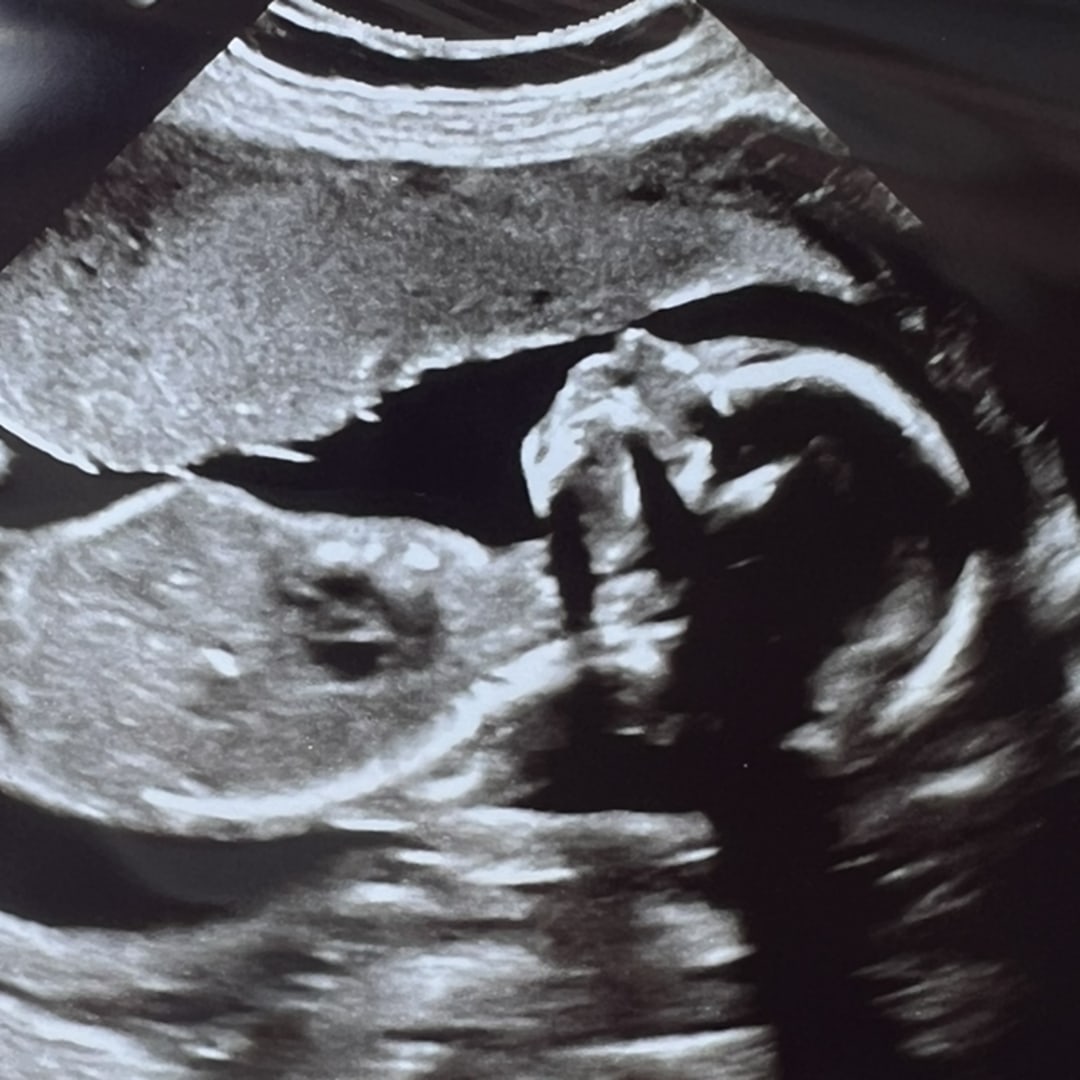 Photo shared by Mysti for their Babylist baby registry.