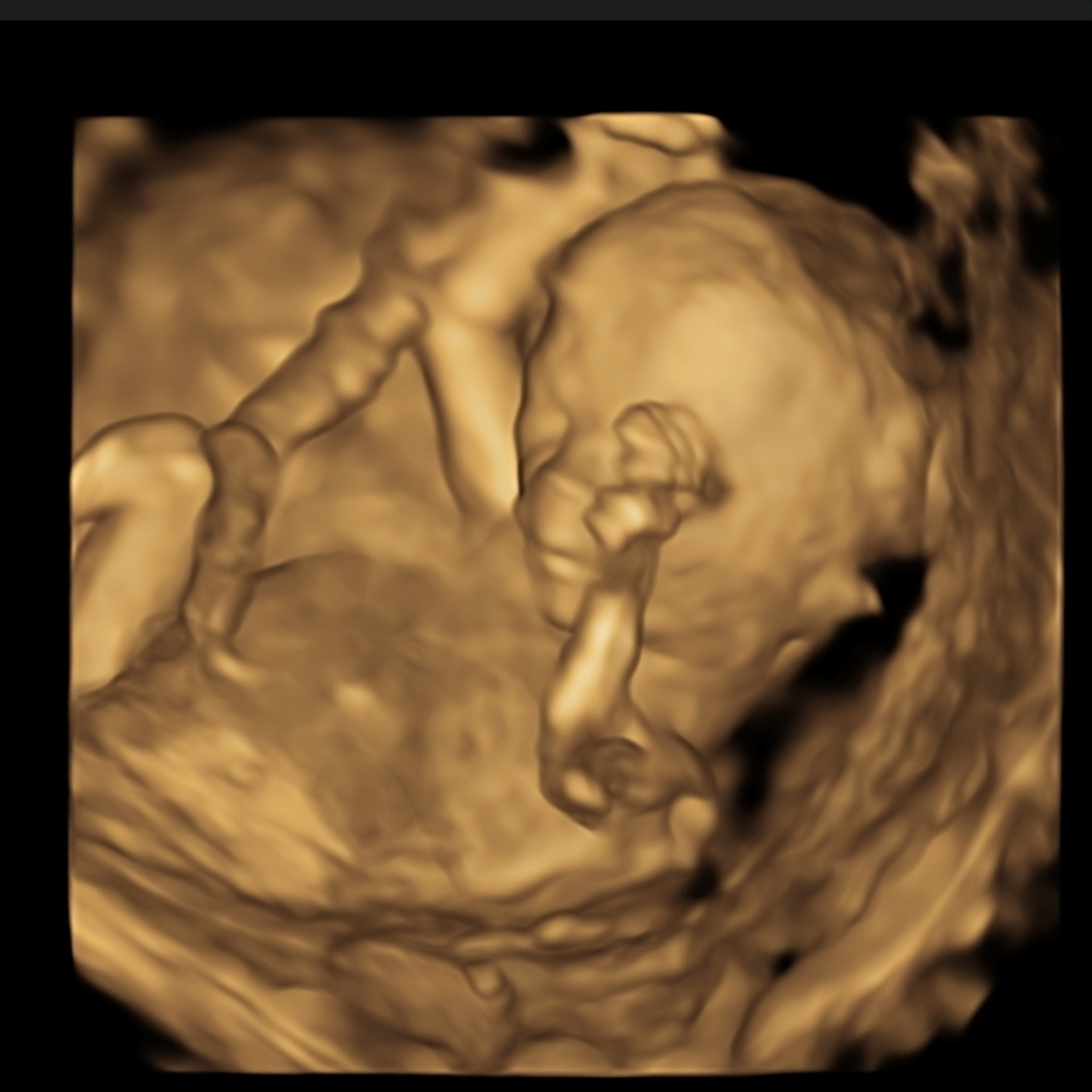 Photo shared by Mari for their Babylist baby registry.