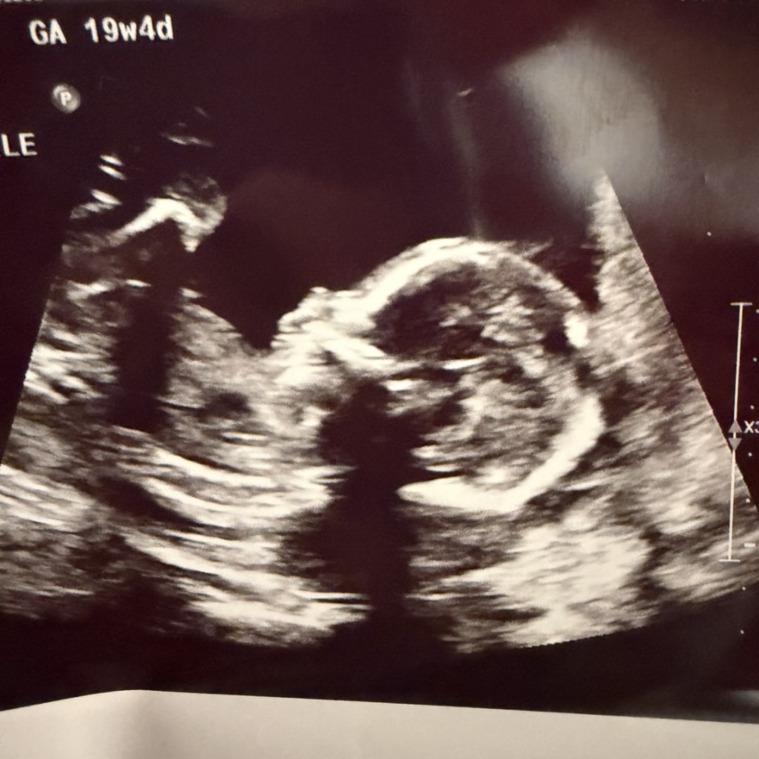 Photo shared by Ashley for their Babylist baby registry.