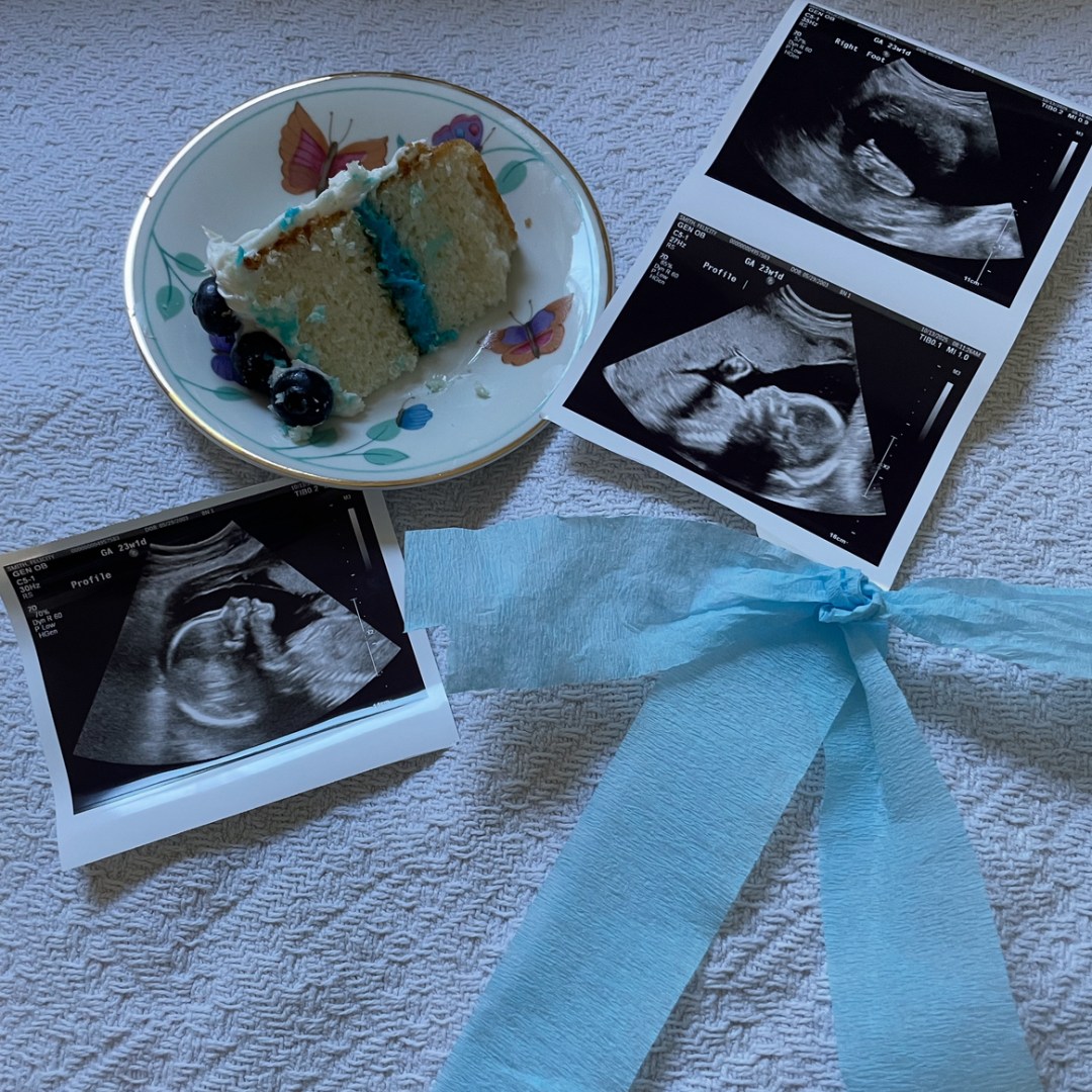 Photo shared by Felicity for their Babylist baby registry.