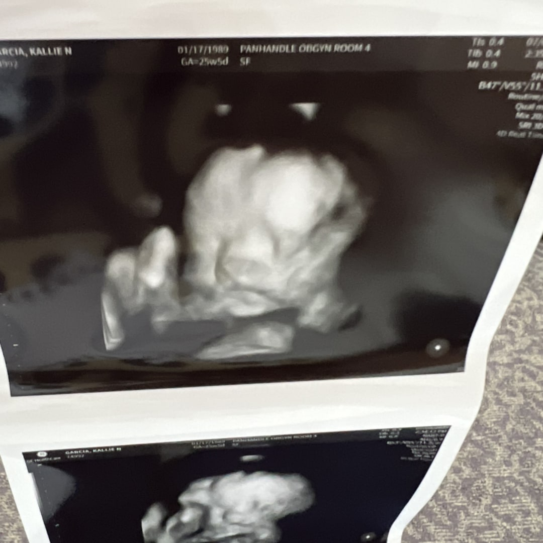 Photo shared by Kallie for their Babylist baby registry.