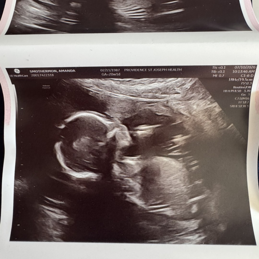 Photo shared by Amanda for their Babylist baby registry.