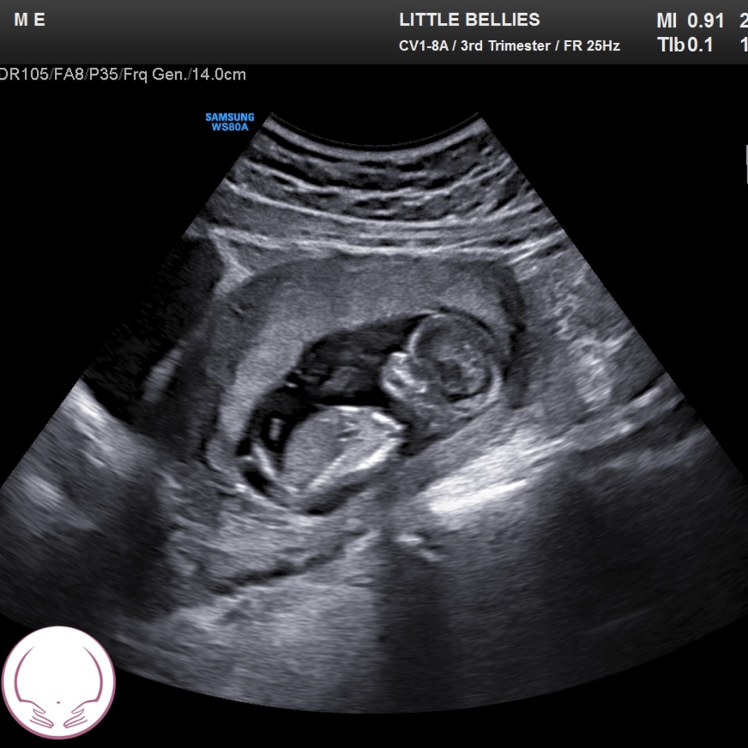 Photo shared by Mallauri for their Babylist baby registry.