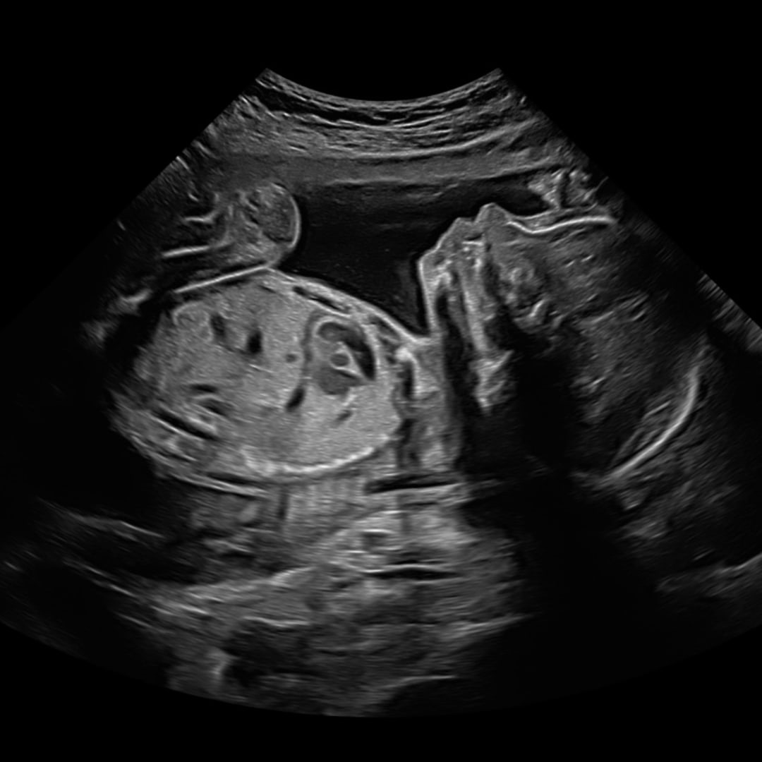 Photo shared by Haven for their Babylist baby registry.