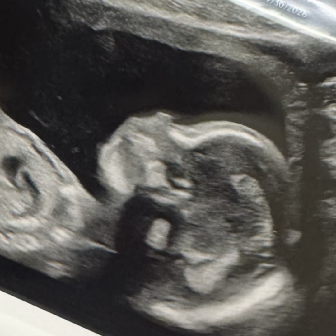 Photo shared by Jenna for their Babylist baby registry.