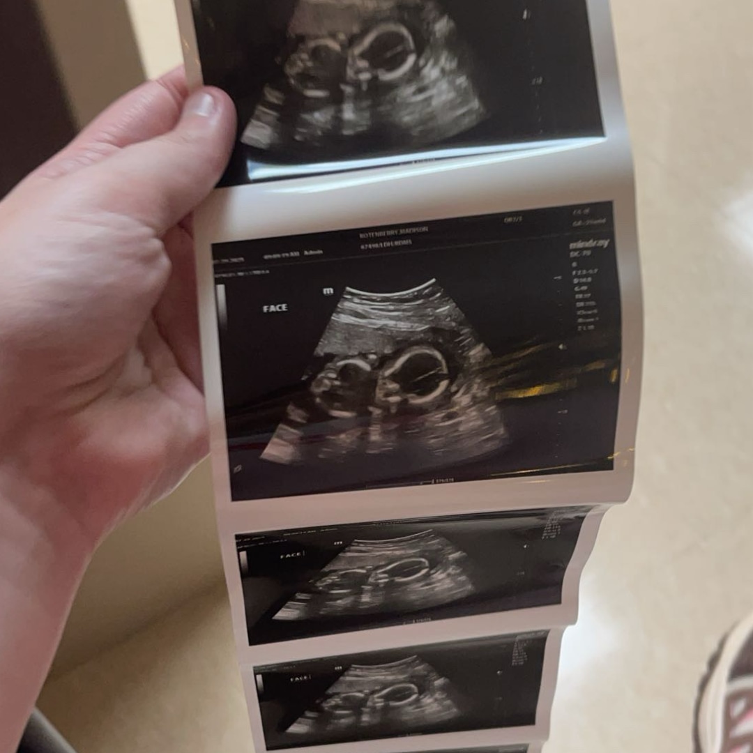 Photo shared by Madison for their Babylist baby registry.