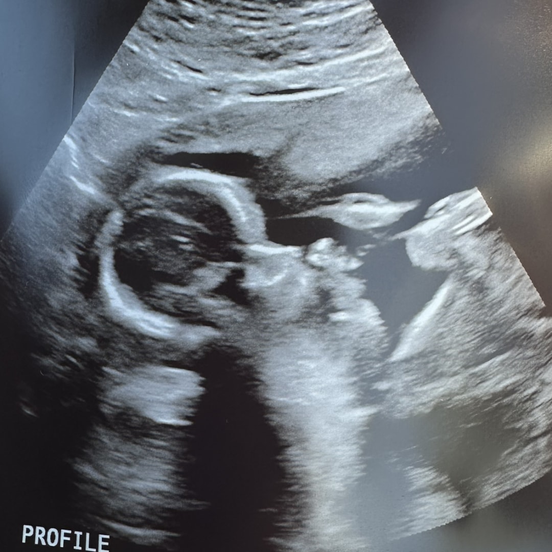 Photo shared by Rachel for their Babylist baby registry.