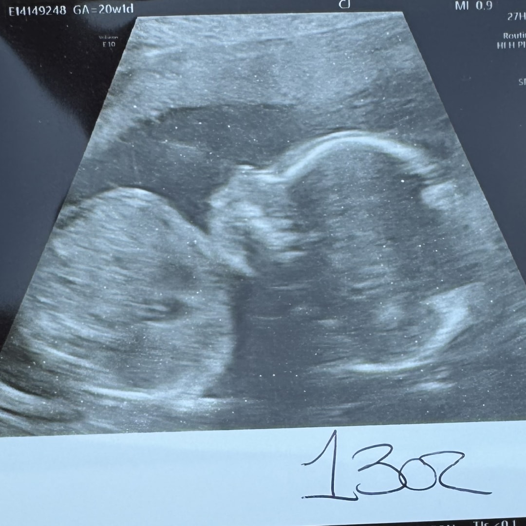 Photo shared by Kimberly for their Babylist baby registry.
