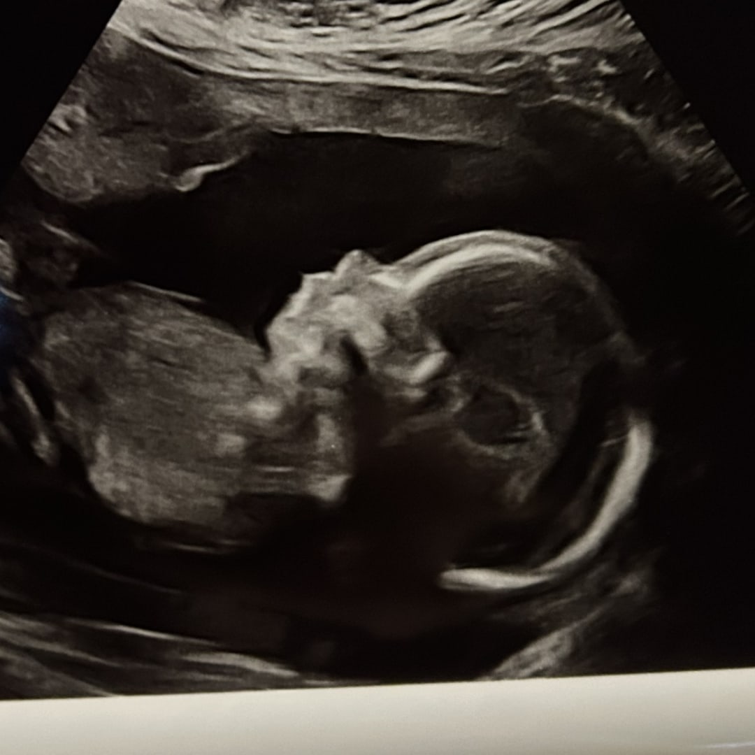 Photo shared by Amy for their Babylist baby registry.