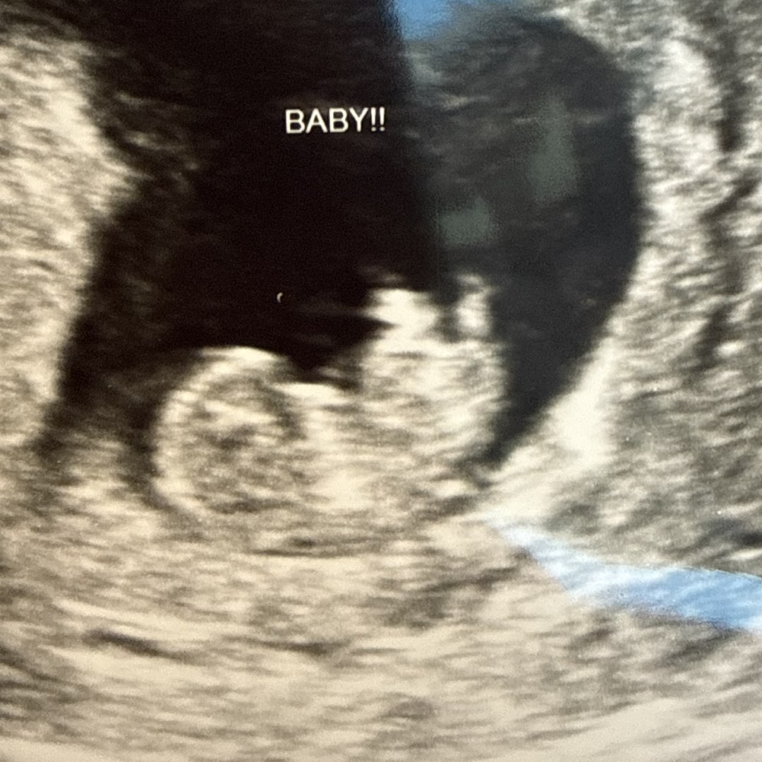 Photo shared by Justina for their Babylist baby registry.