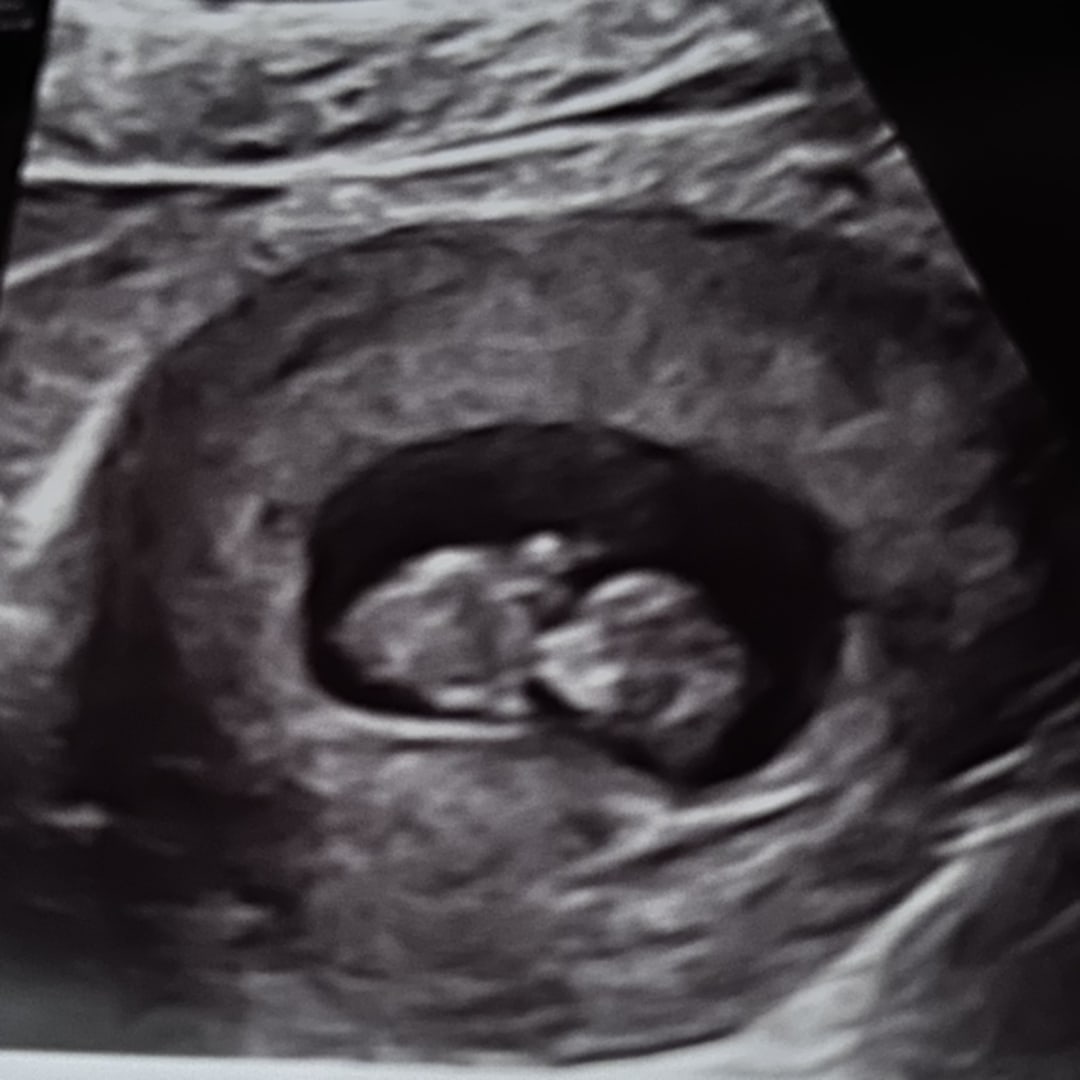 Photo shared by Sabina for their Babylist baby registry.