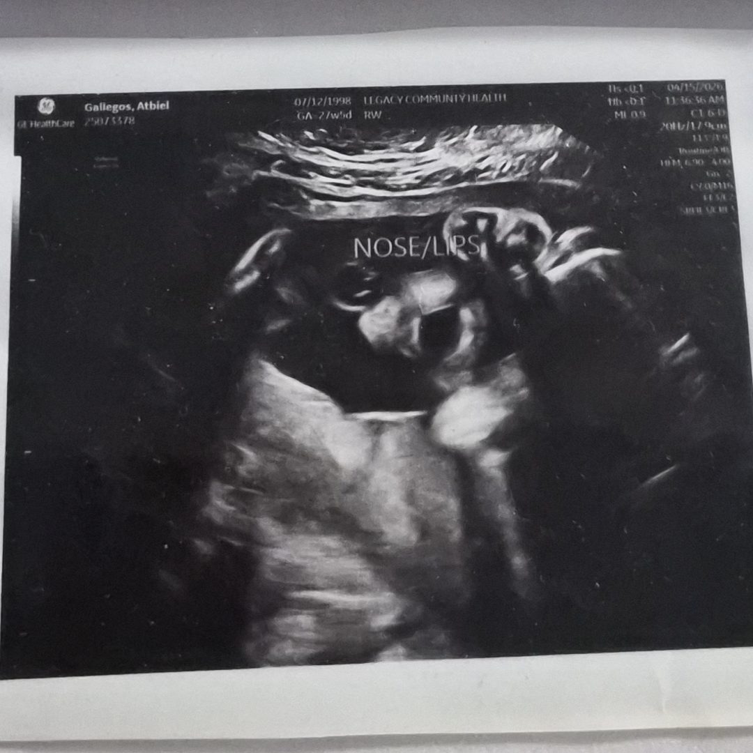 Photo shared by Atbiel for their Babylist baby registry.