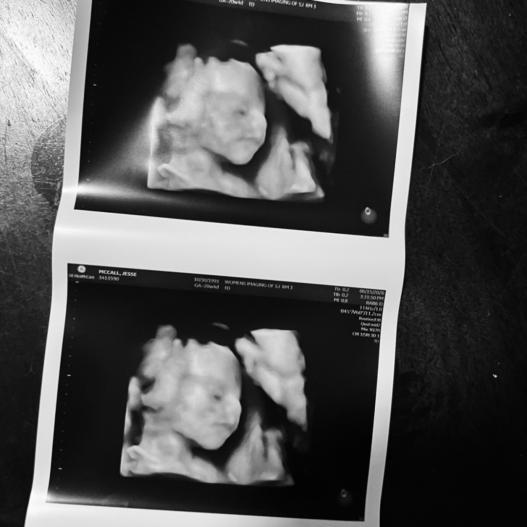 Photo shared by Jesse for their Babylist baby registry.