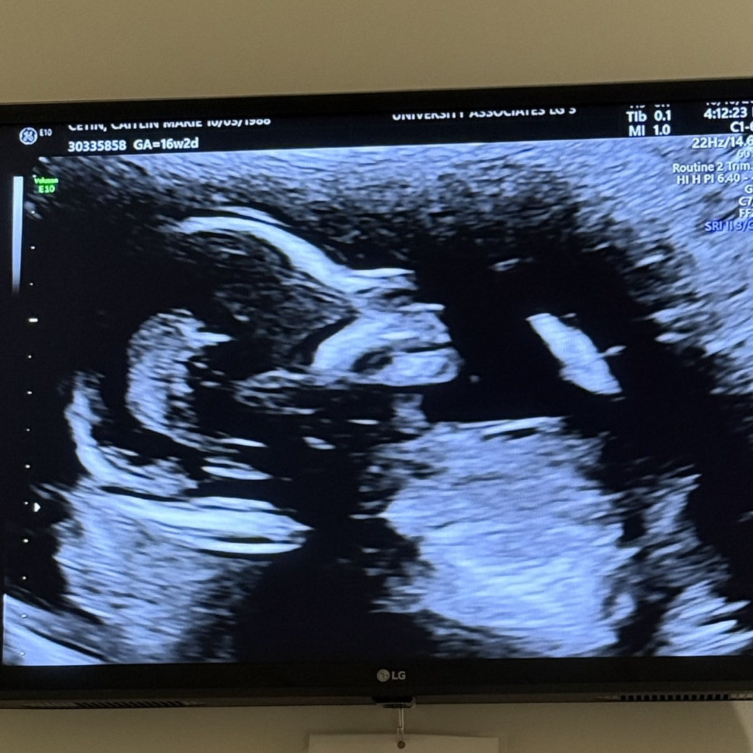 Photo shared by Caitlin for their Babylist baby registry.