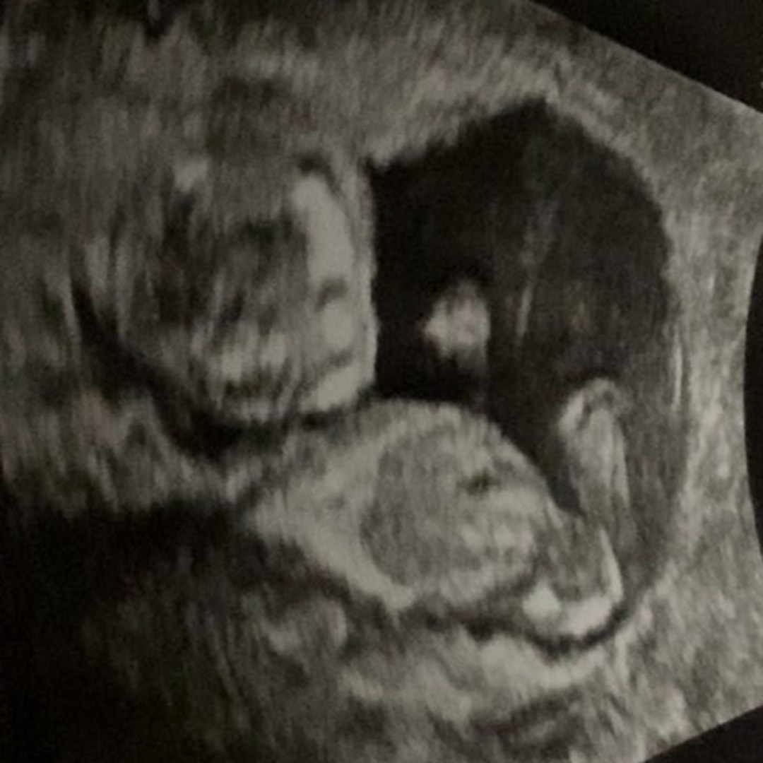 Photo shared by Trinity for their Babylist baby registry.