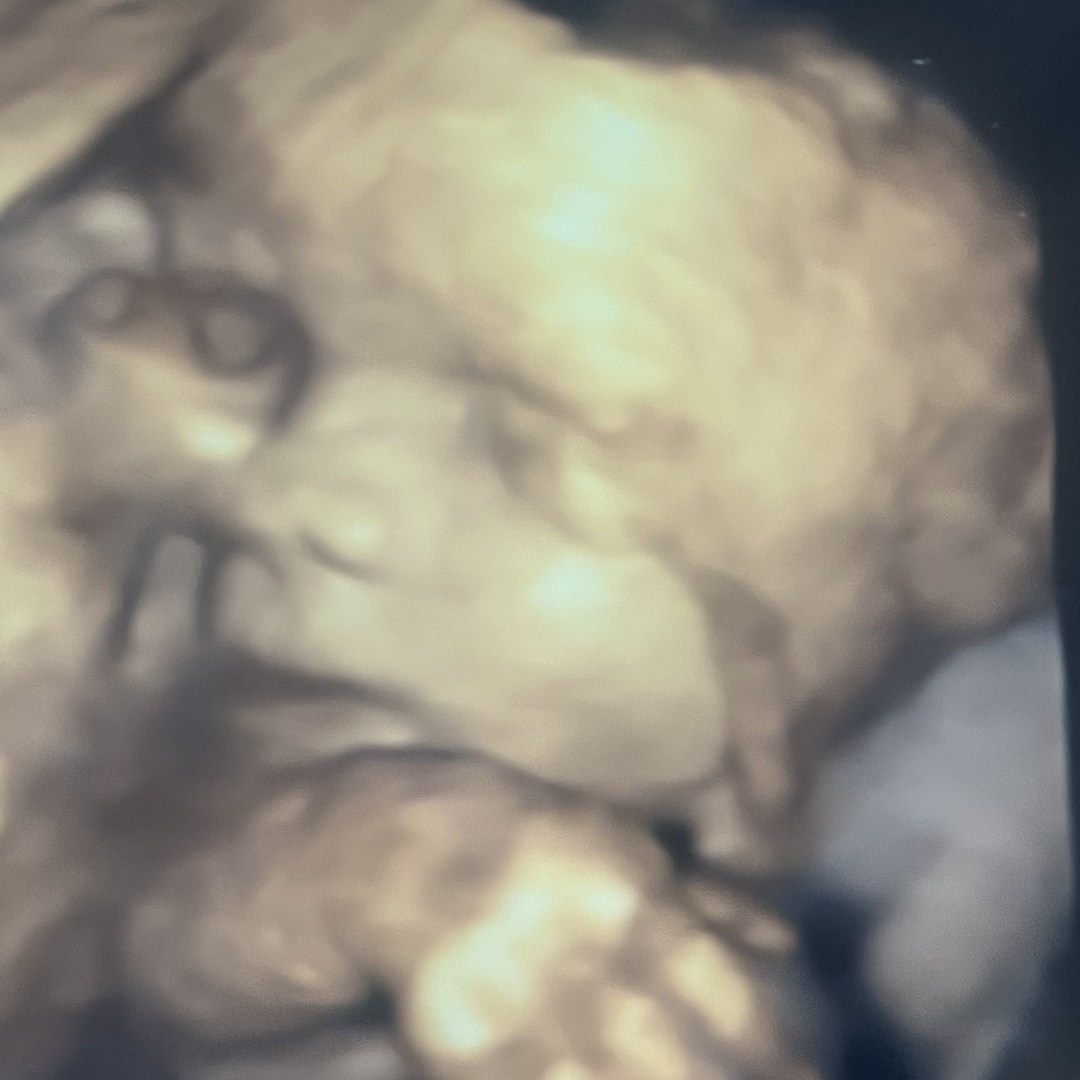 Photo shared by Emily for their Babylist baby registry.