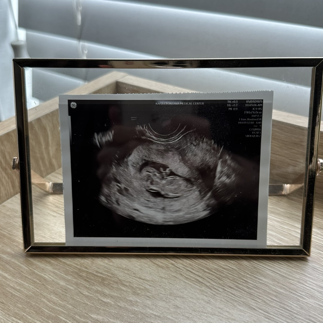 Photo shared by Salma for their Babylist baby registry.