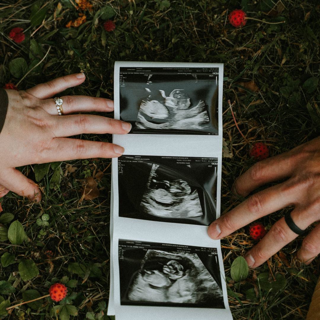 Photo shared by Alexandra for their Babylist baby registry.