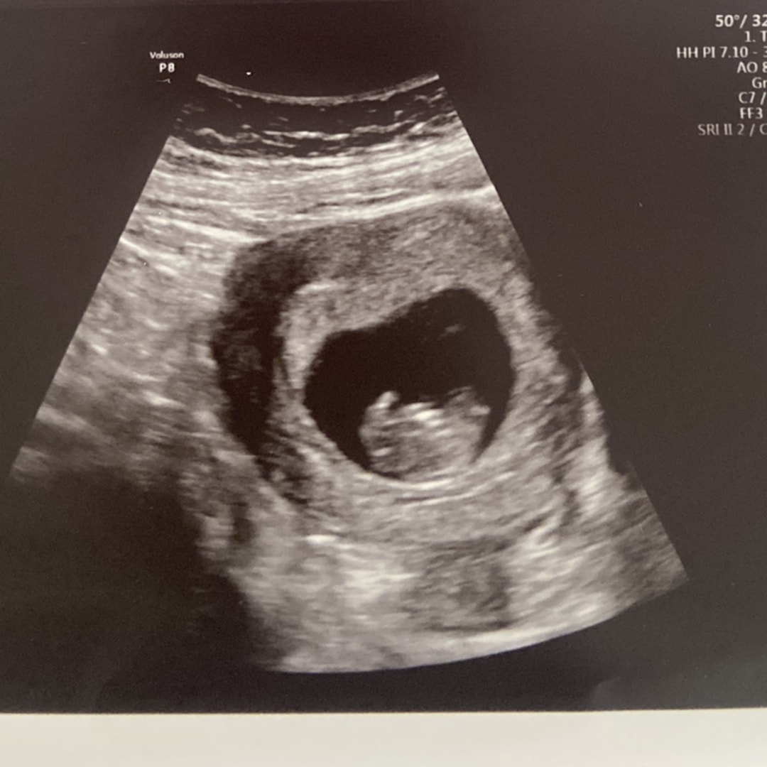 Photo shared by Suzanna for their Babylist baby registry.