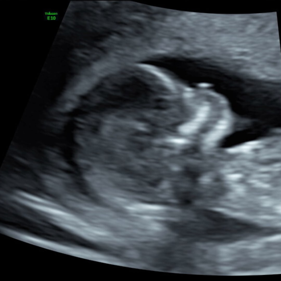 Photo shared by Bekah for their Babylist baby registry.