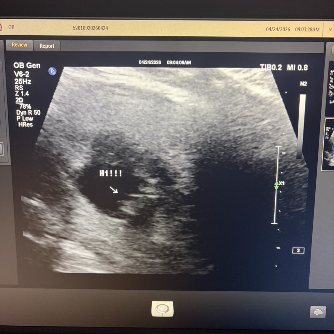 Photo shared by Tori for their Babylist baby registry.