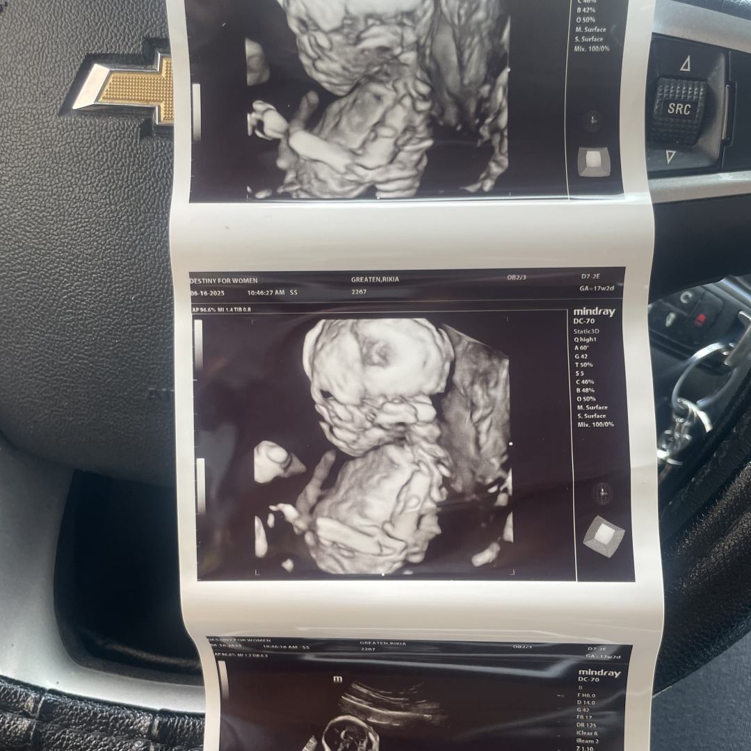 Photo shared by Rikia for their Babylist baby registry.