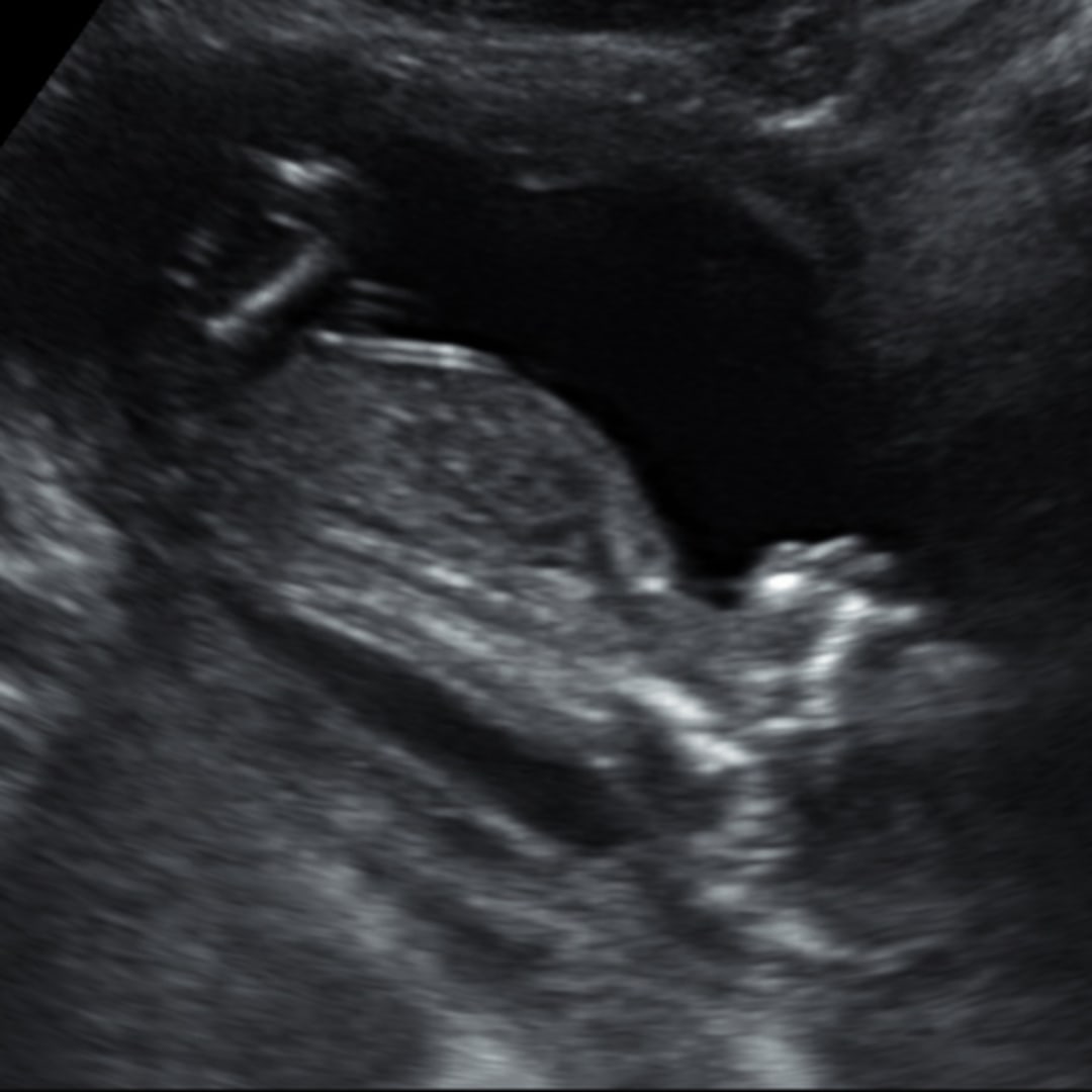 Photo shared by Serenity for their Babylist baby registry.