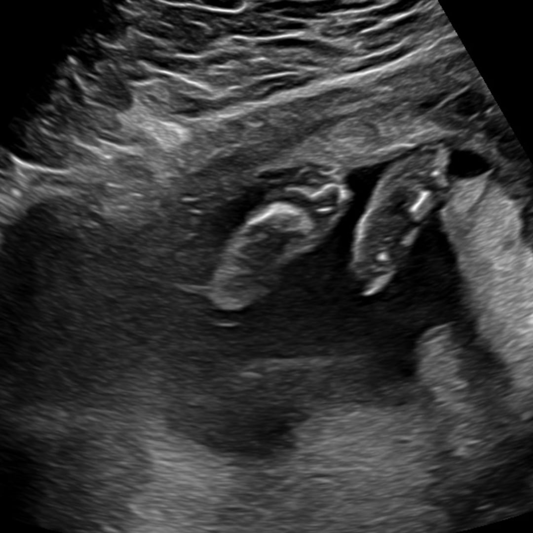Photo shared by Grace for their Babylist baby registry.