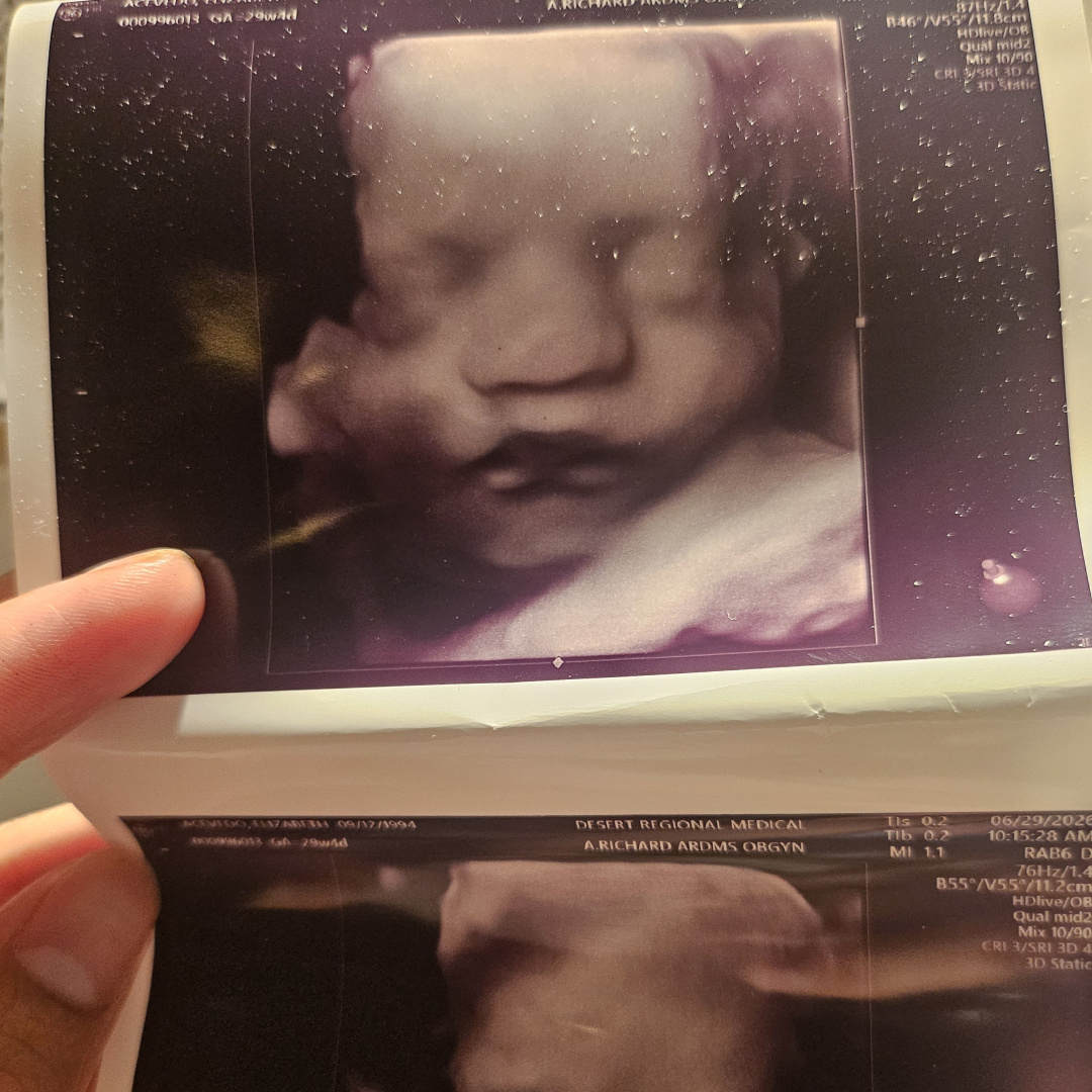 Photo shared by Elizabeth for their Babylist baby registry.