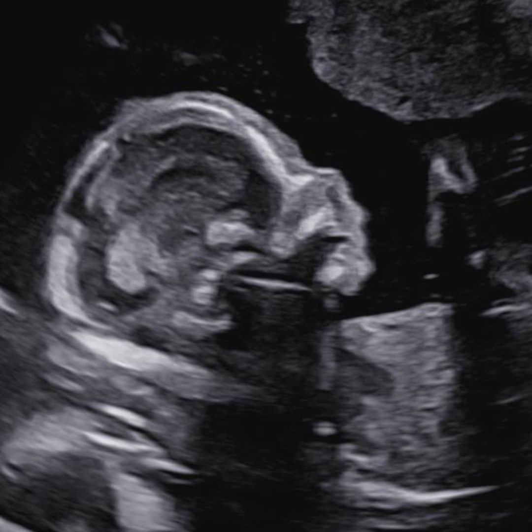 Photo shared by Elyce for their Babylist baby registry.